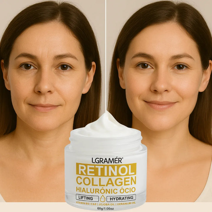 CREME-ANTI-RUGAS-RETINOL